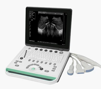 YD-7 дешевый ультразвуковой сканер для ноутбука, ультразвуковая черно-белая Система визуализации, Ультразвуковой сканер, Оборудование ecografo portatil